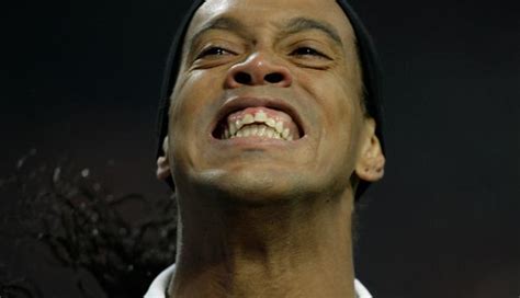 Os Dentes Novos De Ronaldinho Ga Cho