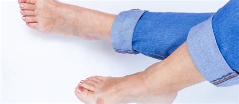The Road To Recovery: Healing From Bunion Surgery In 6 Crucial Stages