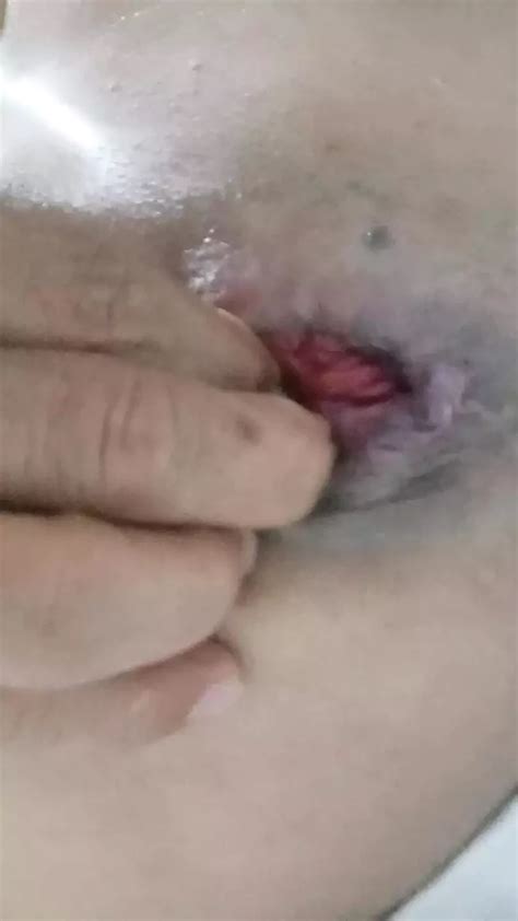 What A Delicious Ass Colombian Gay Amateur Amateur Porn XHamster