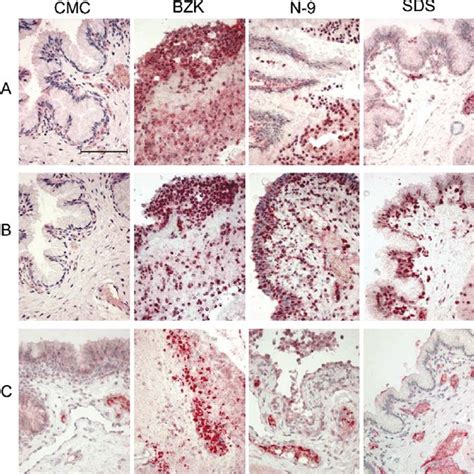 Representative Photomicrographs Comparing Immunohistochemical Findings Download Scientific