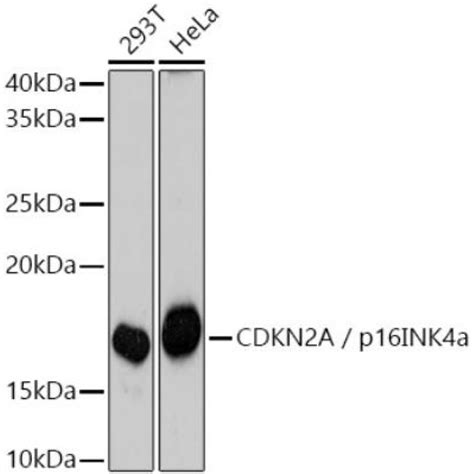 Solarbio K P Anti Cdkn A P Ink A Rabbit Polyclonal Antibody