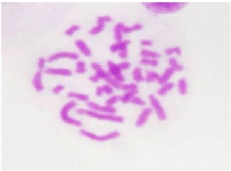 Photomicrograph Of Metaphase Stage In Rat Bone Marrow After Treatment