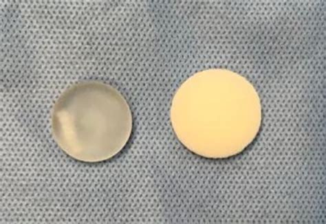 Mini Silicone Implants Nanotextured And Mini Implants Coated With