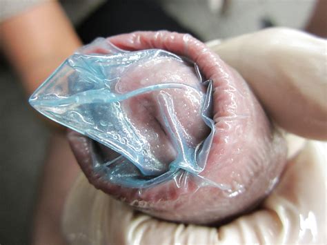 Alles Mit Condom Porn Pictures Xxx Photos Sex Images Pictoa