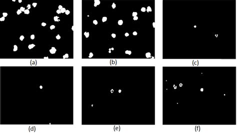 Images after eliminating Platelets and isolated pixels. | Download ...