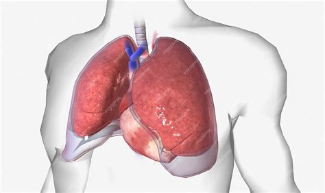 Premium Photo Pleural Effusion Is A Lung Condition Characterized By