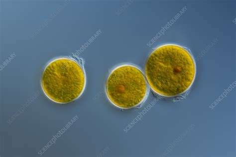 Algae Light Micrograph Stock Image C0594091 Science Photo Library