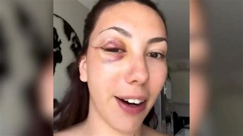 Onlyfans Model Katharina Amalia Packt Bei Rtl Ber Sex Mit Bundesliga Stars Aus