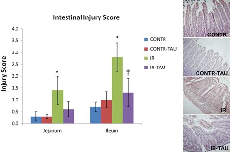 Effect Of Intestinal IR And TAU Administration On Intestinal Injury