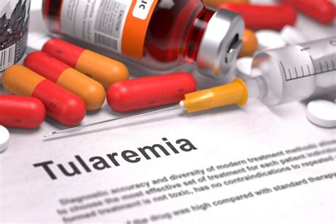 What Are The Causes Symptoms And Treatments Of Tularemia Health