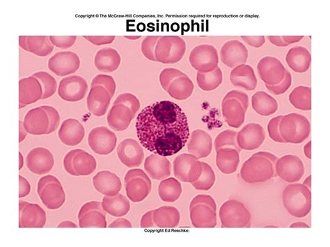 1 Altered Hematologic Function Part 2 2 Alterations In Leukocytes And