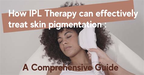 How IPL Therapy Can Effectively Treat Skin Pigmentation - Allwhite Laser