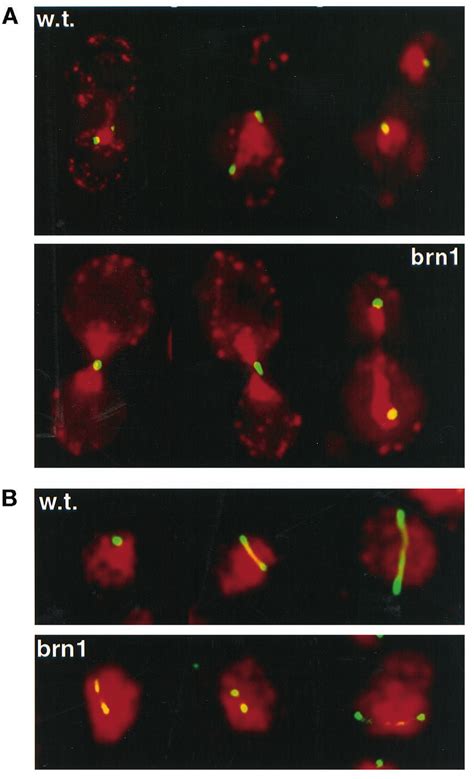 A Chromatid Separation And Segregation In BRN1 W T And Brn1 60