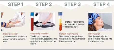 prp skin treatment melbourne prp  skin rejuvenation