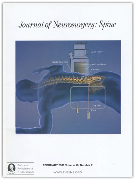 Nucleus replacement technologies in: Journal of Neurosurgery: Spine