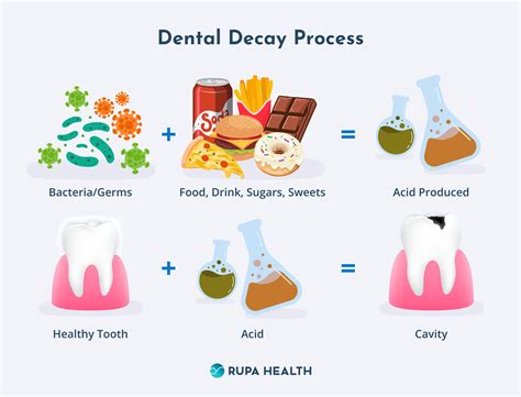 Tooth Tales: The Not-So-Sweet Impact of Sugar on Dental Decay