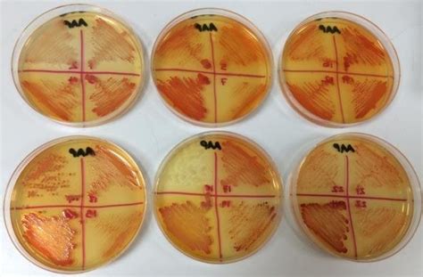 Showing Growth And Colouration Of Gram Negative Isolates As Follows A