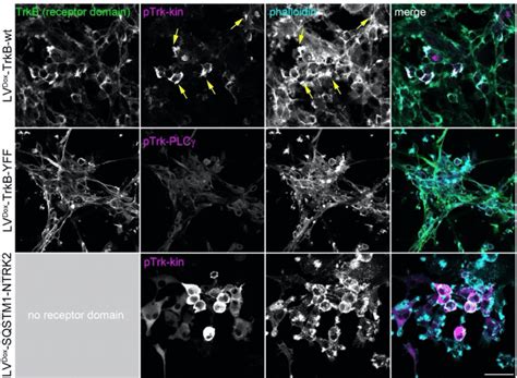 U Mg Cells Expressing Active Trk Kinase Undergo Self Activation And