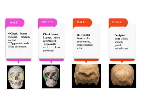 Sex Determination From Skull Ppt