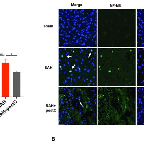 Ab Isoflurane Conditioning Attenuates Nf Kb Activation After Sah In