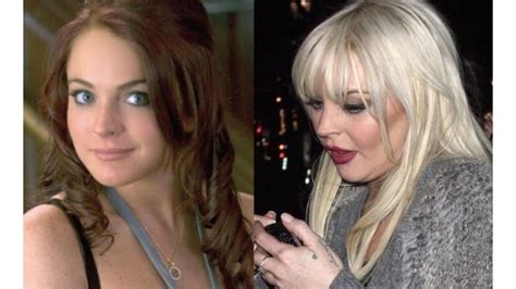 Worst Cases Of Celebrity Plastic Surgery Gone Wrong