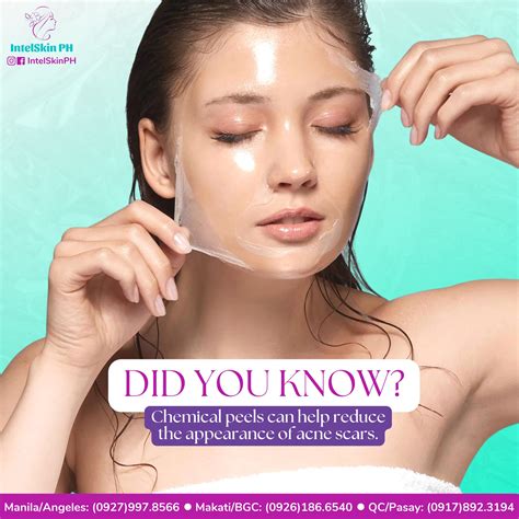 IntelSkin PH - 𝘐𝘧 𝘺𝘰𝘶'𝘷𝘦 𝘣𝘦𝘦𝘯 𝘦𝘹𝘱𝘦𝘳𝘪𝘦𝘯𝘤𝘪𝘯𝘨 𝘵𝘩𝘦𝘴𝘦 𝘴𝘪𝘵𝘶𝘢𝘵𝘪𝘰𝘯𝘴 𝘧𝘰𝘳 𝘢 𝘮𝘦𝘳𝘦