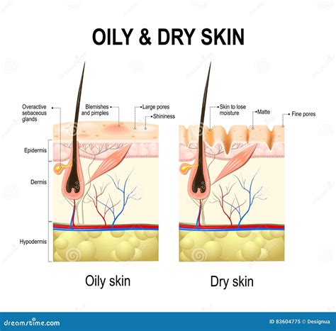 Oily and dry skin stock vector. Illustration of labeled - 83604775