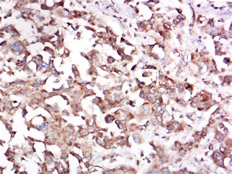 Rabbit Anti Cd68 Polyclonal Antibody 爱必信absin官网
