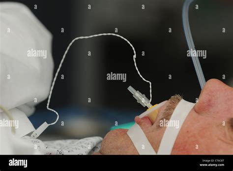 Tracheal Intubation Stock Photo 49313848 Alamy