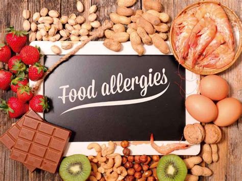 Qu Alimentos Causan Alergias S Ntomas Food Allergies Food