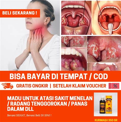 Obat Tenggorokan Bengkak Sebelah Kanan Obat Tenggorokan Berlendir Dan