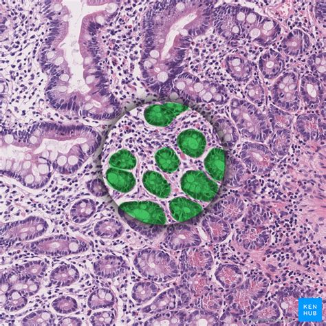 Cecum And Vermiform Appendix Anatomy And Function Kenhub