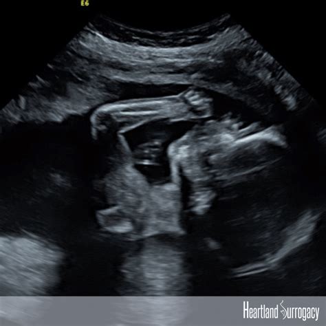 Lgbtq Surrogacy Stories Gay Dads Promoting Surrogacy Heartland Surrogacy