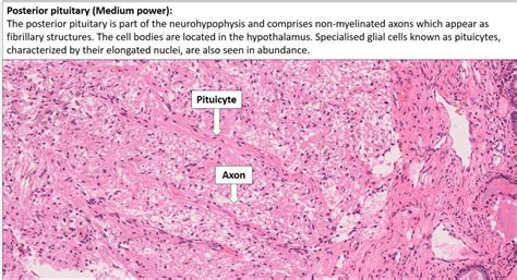 Brain Pituitary Nus Pathweb Nus Pathweb