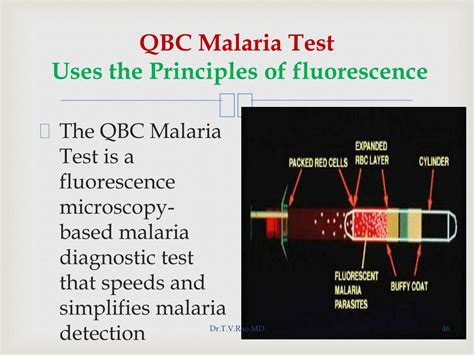 fluorescent microscopy  diagnostic microbiology powerpoint
