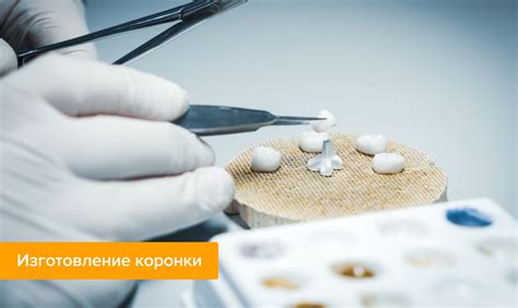 Пластмассовые коронки на зубы – цена, отзывы, фото, этапы установки ...