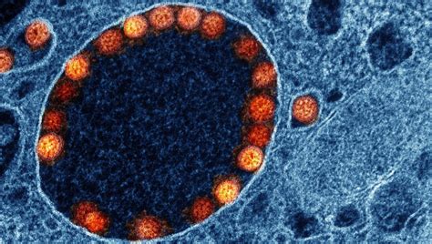 finding  solution  long covid  cell type   time college