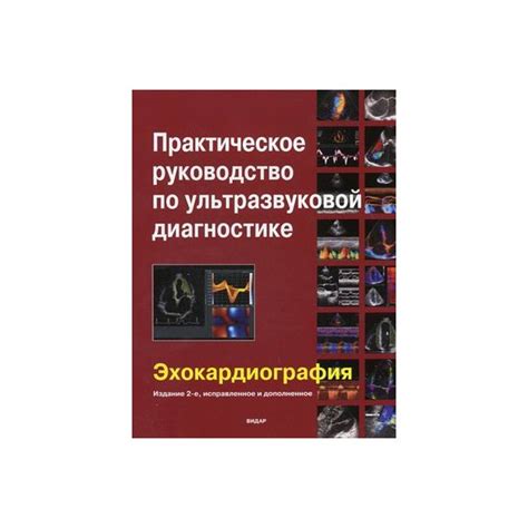 Практическое Руководство По Ультразвуковой Диагностики Эхокардиография ...