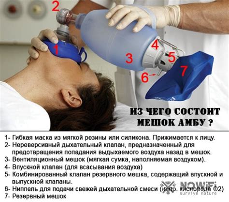 Устройство реанимационное для ручной вентиляции легких типа мешок амбу
