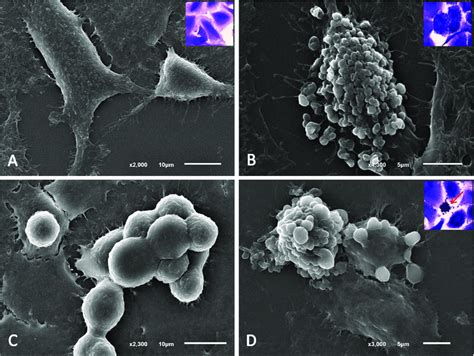 Scanning electron micrographs of A549 cells. A549 cell morphology was... | Download Scientific ...