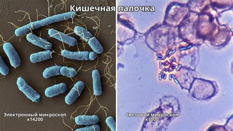 Кишечная палочка под микроскопом | Пикабу
