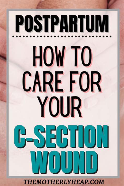 C Section Wound Care How To Care For Your Incision At Home