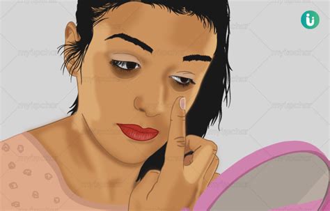 Dark Circles Causes Treatment And Remedies