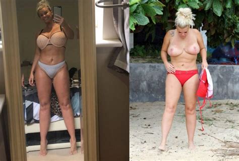 Kerry Katona Nude Fappening Collection Pics The Fappening
