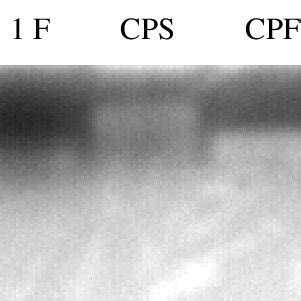 Agarose gel electrophoresis of BK virus PCR products with PEP primers ...