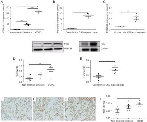 The results of FGG expression in lung tissues and cells. The mRNA ...