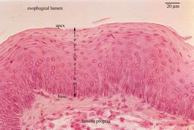 Stratified Squamous Epithelium Slide Labeled