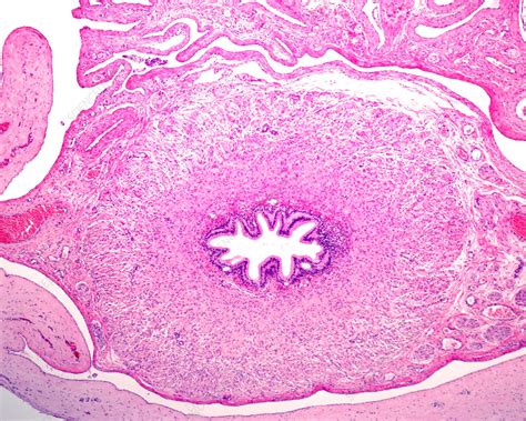 Vas Deferens Slide Jaypeedigital Ebook Reader