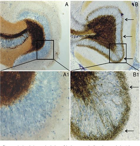 Figure 1 From Effects Of Trpv1 Activation On Synaptic Excitation In The