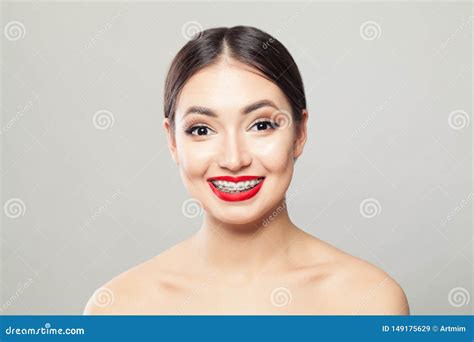 Attractive Brunette Woman In Braces Smiling On White Background Stock Image Image Of Healthy